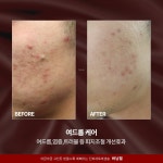 디오 퀸 에스테틱 | 퀸에스테틱