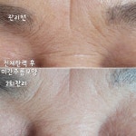 뉴건강가꾸기피부샵 | 건강한피부샵