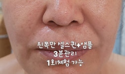 뉴건강가꾸기피부샵 | 건강한피부샵