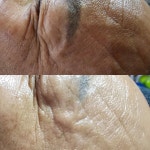 뉴건강가꾸기피부샵 | 건강한피부샵