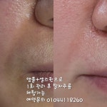 뉴건강가꾸기피부샵 | 건강한피부샵