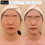 에소테릭명상에스테틱 | 온플릭에스테틱