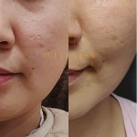 웰니스라운지 방배본점