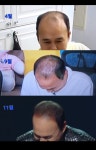 루비셀뷰티랩 영통점