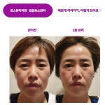도드리뷰티어겐 | 강스뷰티어겐