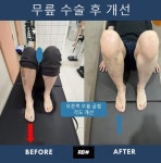 후기
