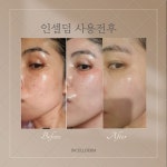 새금빛인셀덤 | 인셀덤