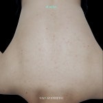와이젯에스테틱(YZETAESTHETIC) | 와이젯 에스테틱