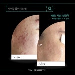 와이젯에스테틱(YZETAESTHETIC) | 와이젯 에스테틱