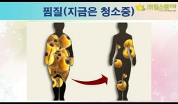 힐스템건강찜질황등점 | 힐스템건강찜질 여서점