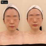 에소테릭명상에스테틱 | 온플릭에스테틱