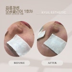 에스오(SO) 에스테틱 | 에스테틱 시오