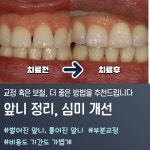 바른정플란트치과의원북구 | 이바른치과교정과치과의원 울산북구송정점