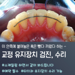 바른정플란트치과의원북구 | 이바른치과교정과치과의원 울산북구송정점
