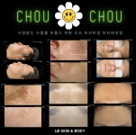 엘비스킨앤바디
