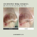 엘비스킨앤바디
