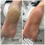 푸스케어 용인기흥점