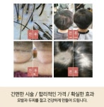 후기