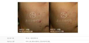 존스킨한의원 안양