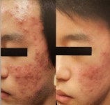 한불피부관리실 봉곡점 | 한불피부샵
