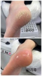 푸스케어 용인기흥점