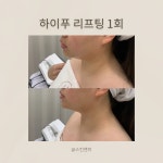 스킨엔아이153 | 스킨앤미