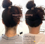 늘여기바이미(채움뷰티) | 채움늘beauty