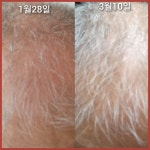 스칼렛포톤힐링센타 | 주영뷰티바이오포톤힐링센터