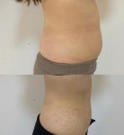 (personal) 턴 에이지 | 턴에이지