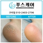 푸스양주 | 푸스케어 구리점