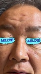 (personal) 턴 에이지 | 턴에이지