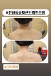 썬테라피