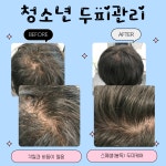 염색앤두피 개봉점 | 염색앤두피이문