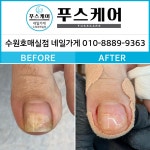 푸스케어수원이든네일 | 푸스케어 수원호매실점 네일가게
