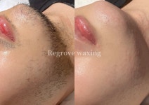 리그로브 왁싱(Regorve waxing) | 리그로브왁싱