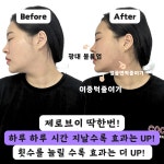 온델라 피부개선센터 시흥은계점