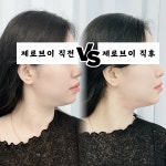 온델라 피부개선센터 시흥은계점