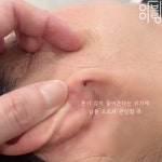 아이블링