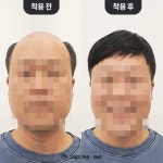 그랜드가발에스엠피 | 그랜드가발 본점