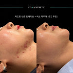 와이젯에스테틱(YZETAESTHETIC) | 와이젯 에스테틱