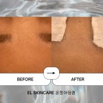 엘스킨케어