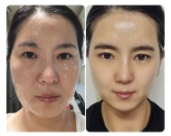 가데리스앤인셀덤 | 라온인셀덤