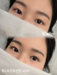 단미·루근뇌에스테틱 | 단미에스테틱