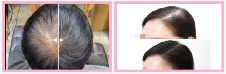 천연머리염색 반림점 | 천연머리염색반림점