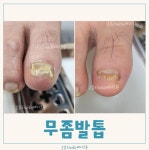 후기
