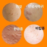 후기