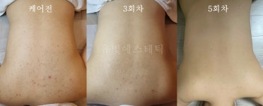 에스테틱the유빛 - 남구 용호로106번길 43-1 | 유빛에스테틱
