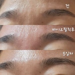 뉴건강가꾸기피부샵 | 건강한피부샵
