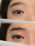 단미·루근뇌에스테틱 | 단미에스테틱