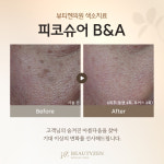 뷰티젠의원 위례